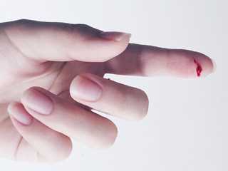 चोट या खरोंच को चाटना है कितना सही? जानें